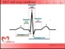 ЭКГ под силу каждому - 2