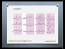 ЭКГ. Анализ комплекса Т.