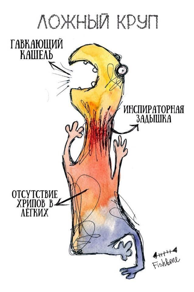 Ложный круп Ложный круп