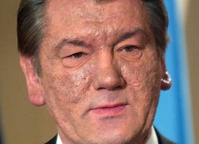 Лепра Лепра
